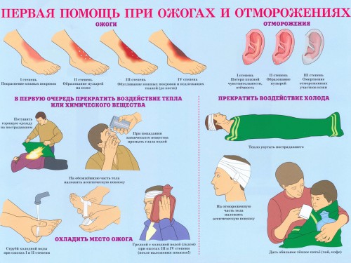 Первая помощь при ожогах и отморожениях