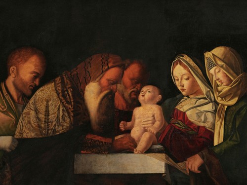 Circumcision